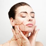 Tips Merawat dan juga juga Mengatasi Kulit Kering